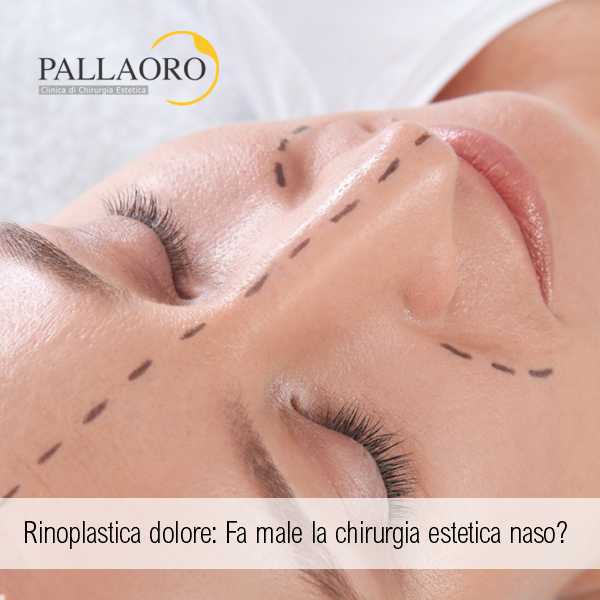 Rinoplastica dolore Fa male la chirurgia estetica naso Rinoplastica dolore Fa male la chirurgia estetica naso
