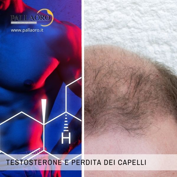 Testosterone e perdita dei capelli