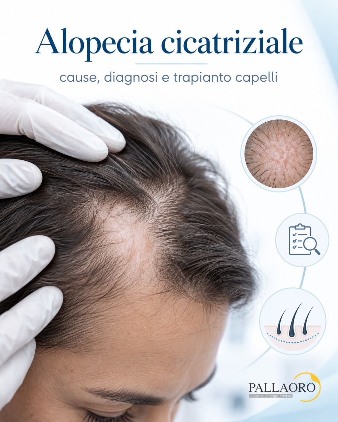 alopecia cicatriziale
