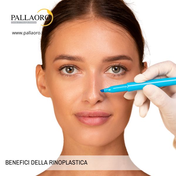 benefici della rinoplastica