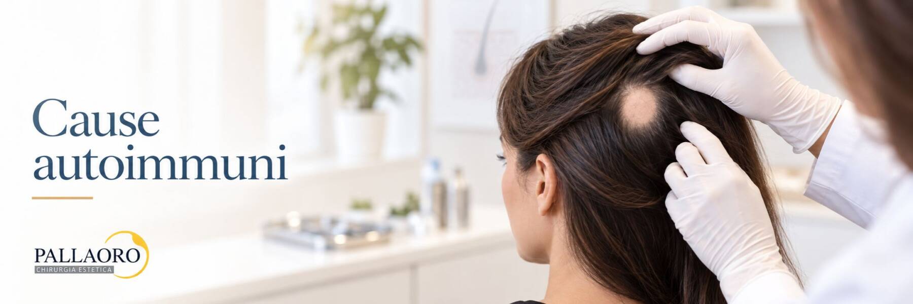 causa alopecia areata