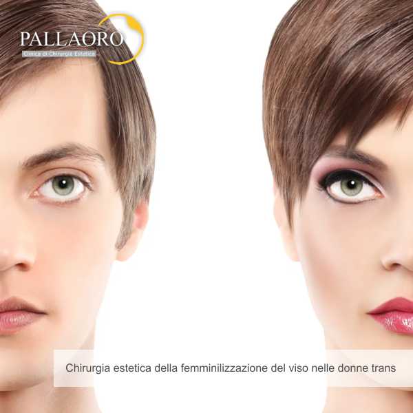 chirurgia estetica della femminilizzazione del viso nelle donne trans