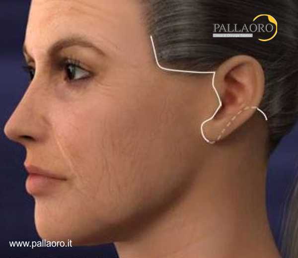 Necrosi Cutanea Immagini E Fotos Stock Alamy