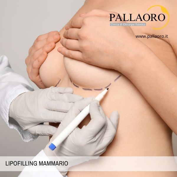 lipofilling mammario lipofilling seno