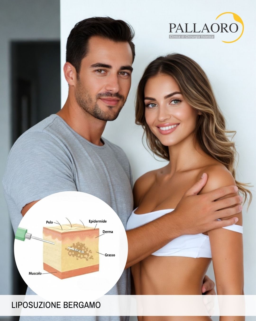 Liposuzione bergamo: Quanto costa?