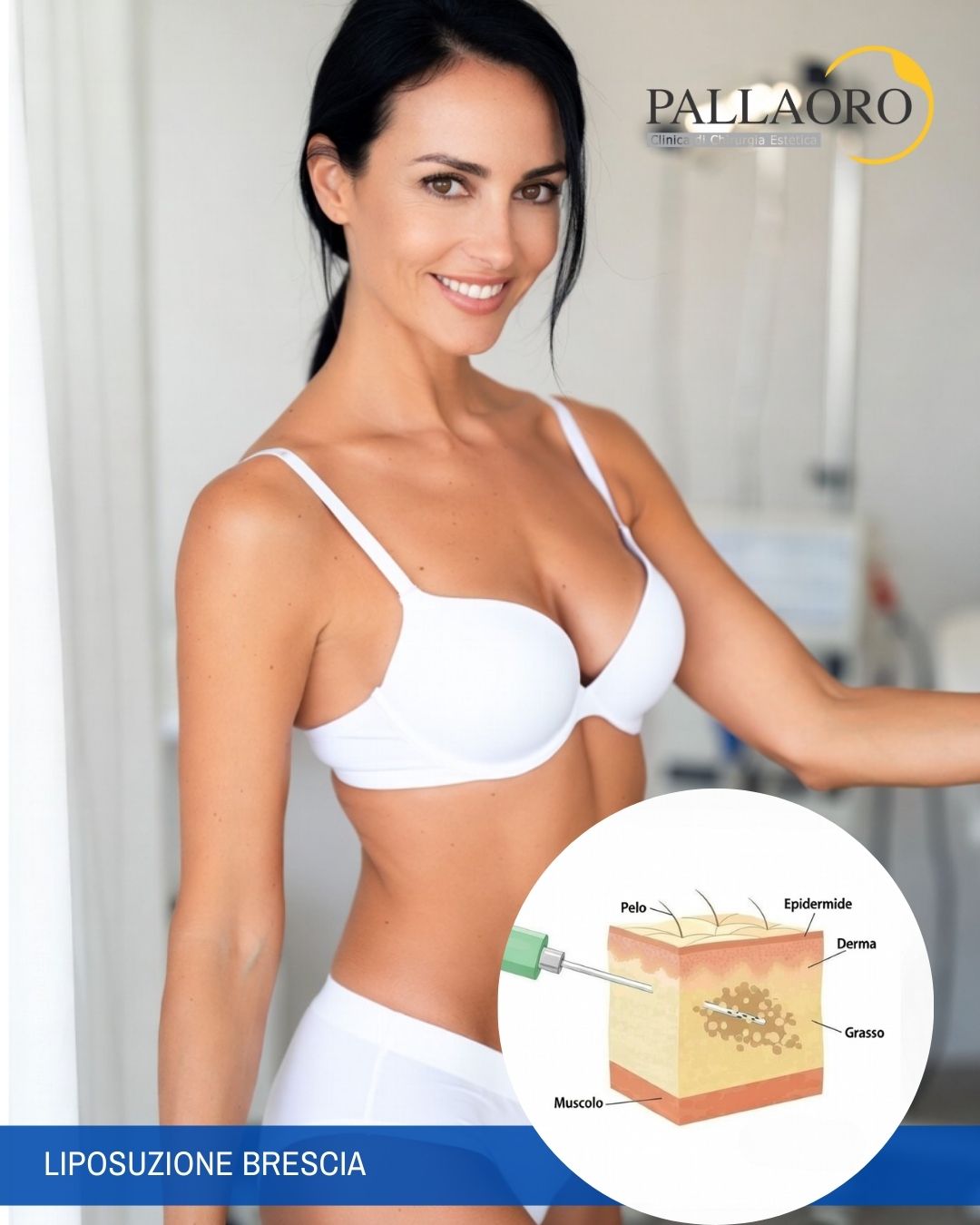 liposuzione brescia