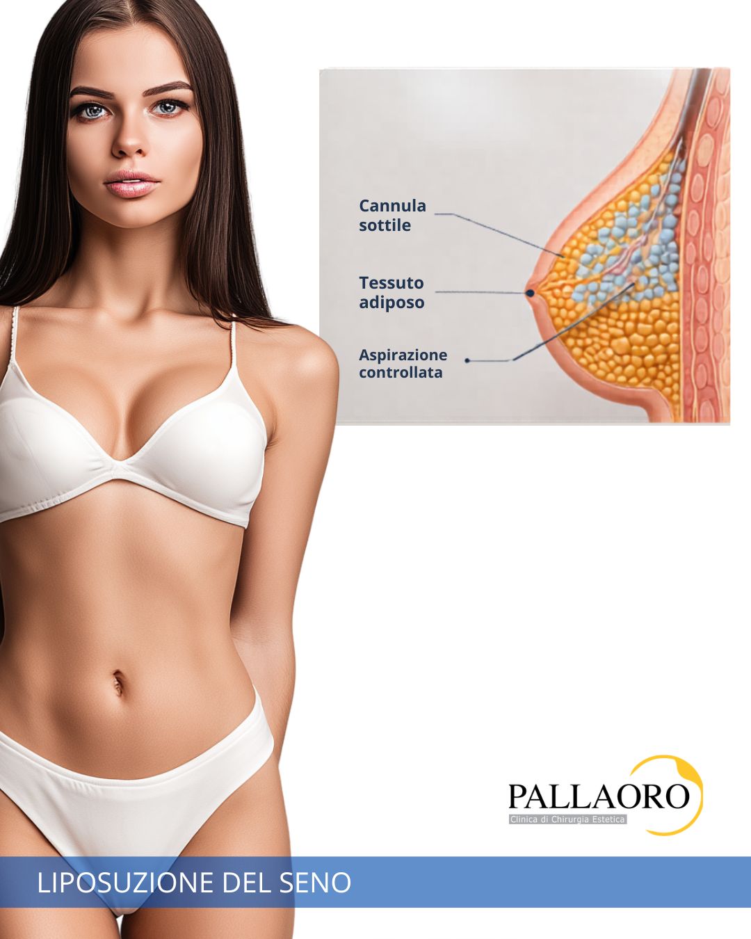 liposuzione seno