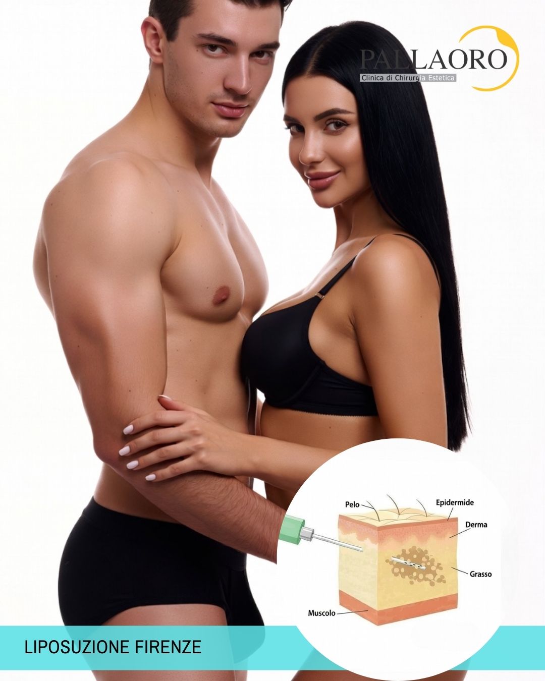 liposuzione firenze