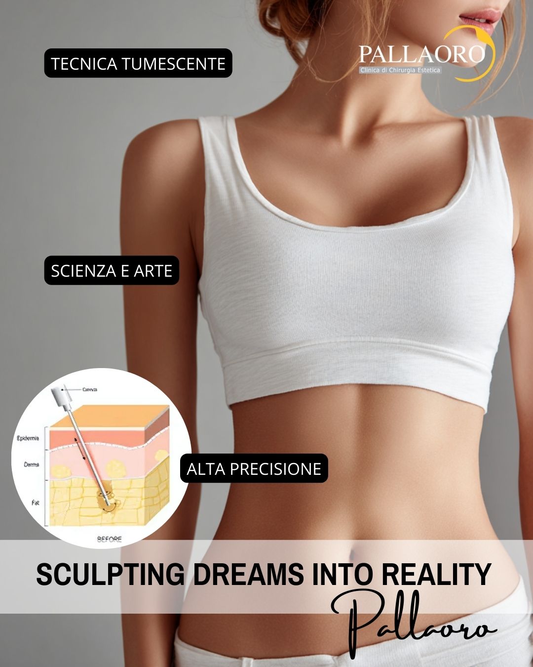 liposuzione milano