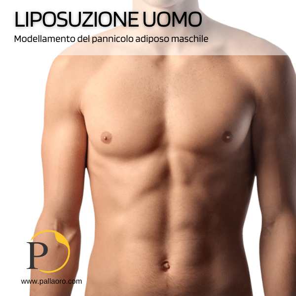 liposuzione uomo