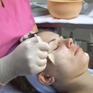 needling crema anestetica needling crema anestetica