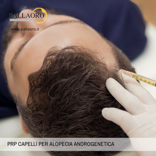 Vantaggi del PRP per i Capelli