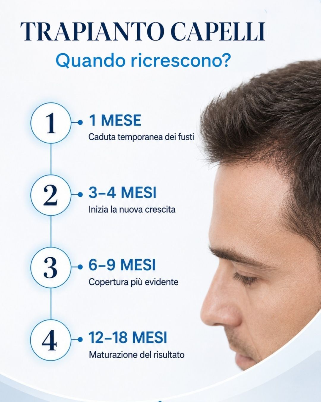 quando ricrescono i capelli trapiantati quando ricrescono i capelli trapiantati