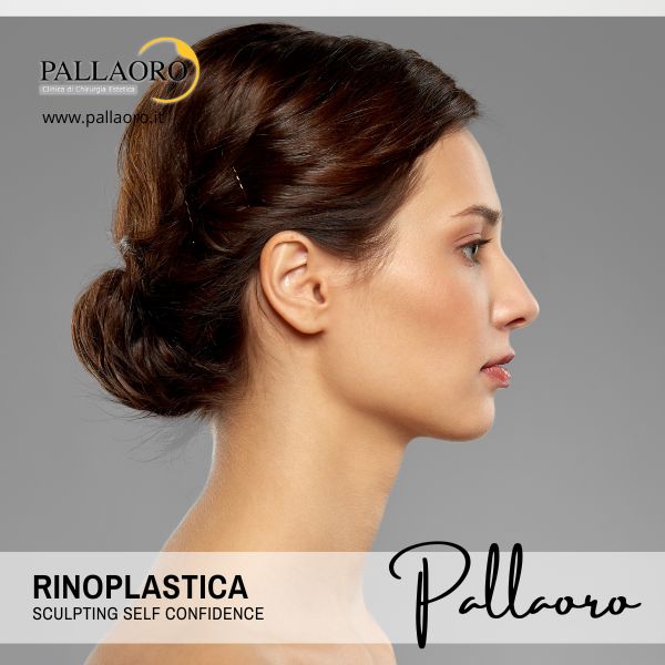 rinoplastica rinoplastica treviso
