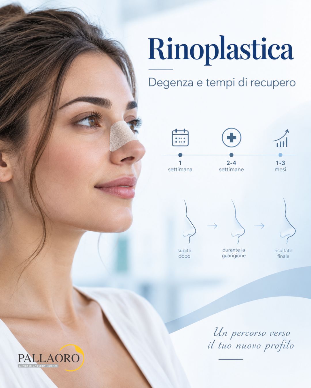 rinoplastica degenza convalescenza rinoplastica degenza convalescenza