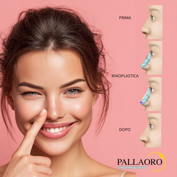 rinoplastica verona