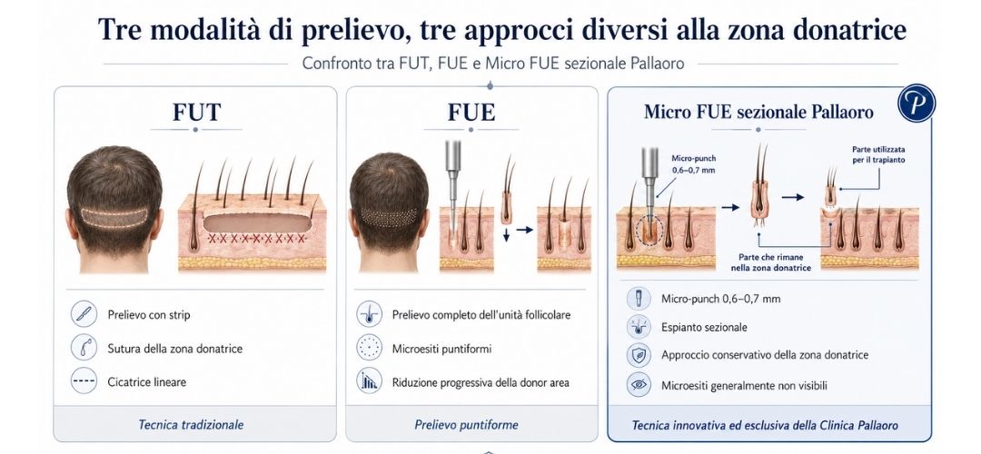 trapianto capelli confronto fut fue micro fue trapianto capelli confronto FUE / FUT/ Micro FUE