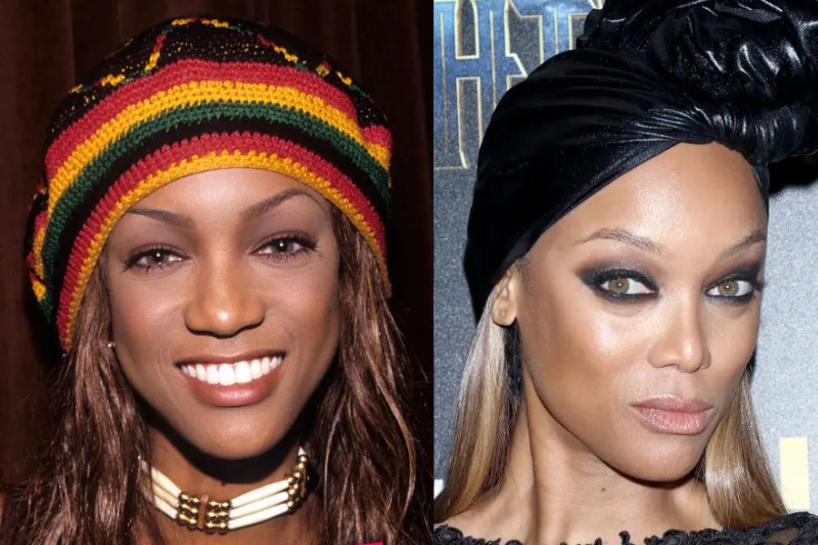 tyra banks rinoplastica prima dopo Tyra Banks e la rinoplastica: la confessione sulla chirurgia estetica
