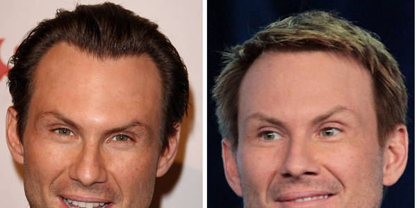 Trapianto capelli Vip - Christian Slater