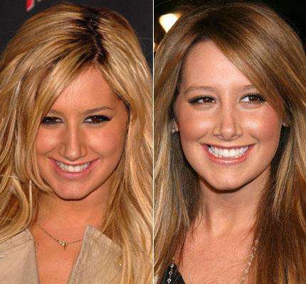 Chirurgia estetica Ashley Tisdale - Amerie: Rinoplastica