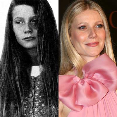 Gwyneth Paltrow : Rinoplastica foto prima e dopo