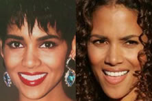 Halle Berry - rinoplastica VIP