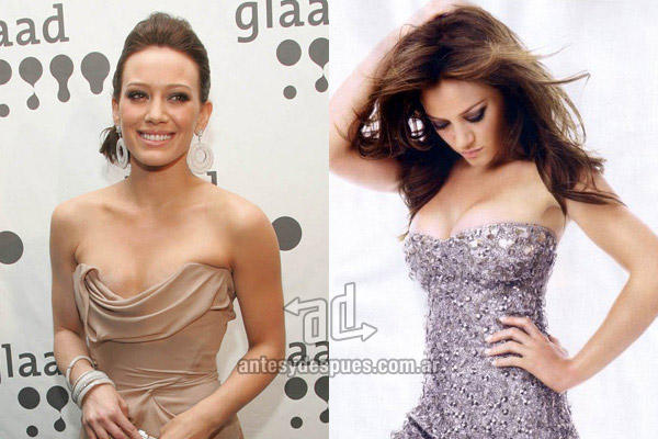 Hilary Duff: Mastoplastica additiva VIP