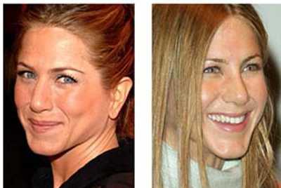 Jennifer Aniston : Rinoplastica
