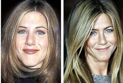 Jennifer Aniston : Rinoplastica