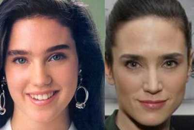 Jennifer Connelly : Rinoplastica