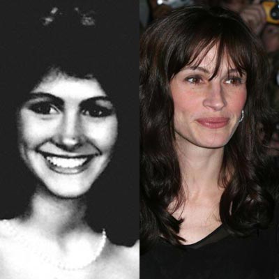 Julia Roberts : Rinoplastica foto prima e dopo