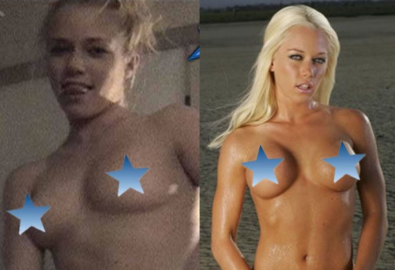 Kendra Wilkinson Mastoplastica additiva