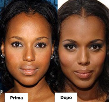 Kerry Washington - Rinoplastica