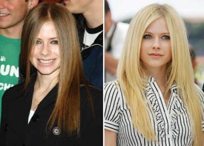 Lavigne Avril: rinoplastica