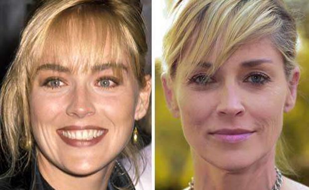 Chirurgia estetica Sharon Stone - Amerie: Rinoplastica