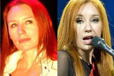 Tori Amos: Rinoplastica